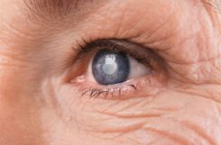 Диабетическая катаракта: причины, симптомы, медикаментозное и хирургическое лечение