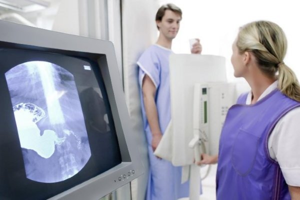 Рентгенография желудка