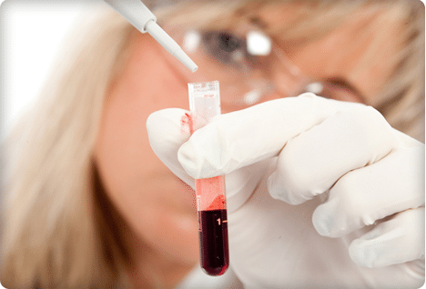 Как готовится к анализу крови на сахар и холестерин thumbnail