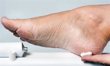 Как вылечить рану на ноге при сахарном диабете народными средствами thumbnail