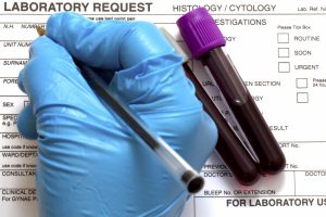Как сделать alt ast анализ крови, и для чего он нужен