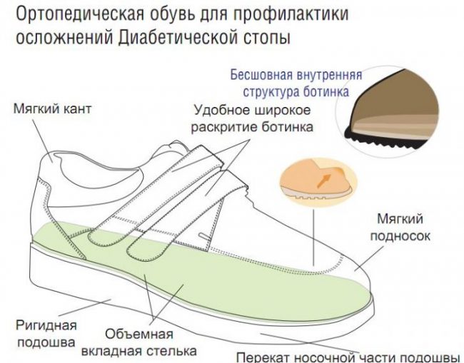 Критерии выбора обуви для диабетической стопы