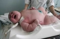 Фетопатия при диабете