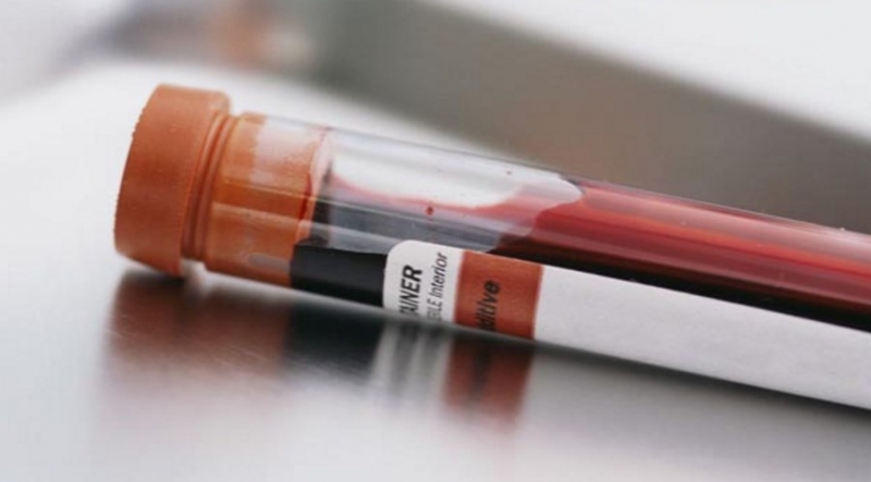 Гликогемоглобин: расшифровка анализа крови (норма)