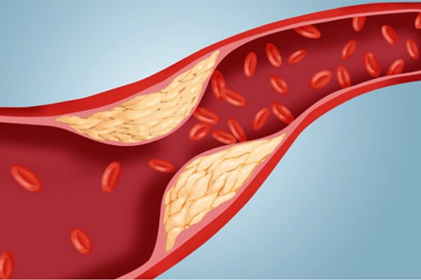Тест полоски для определения холестерина и его измерения в крови: цена