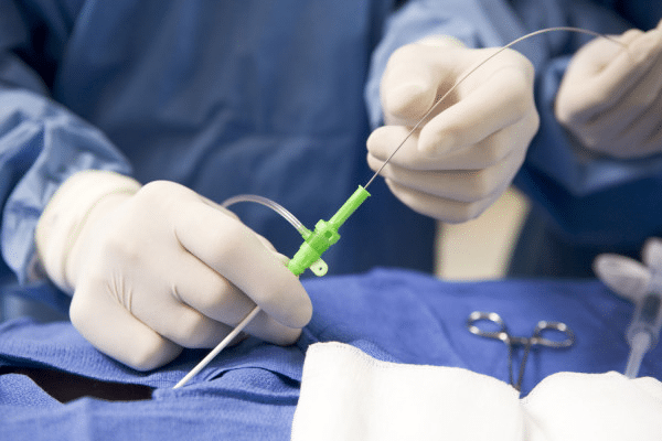 Панкреатэктомия: что это такое, как проходит операция и тотальная хирургическое вмешательство