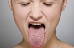Сухость во рту при сахарном диабете 2 типа: причины