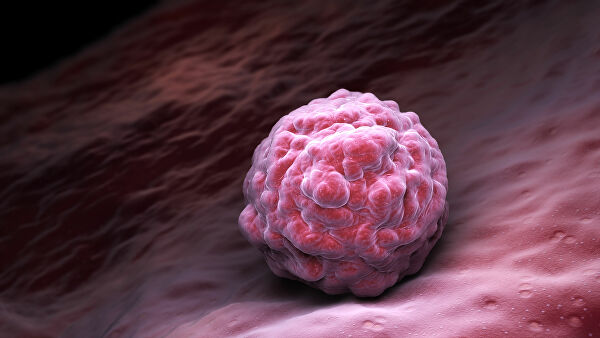 Ученые разработали методику лечения диабета стволовыми клетками 